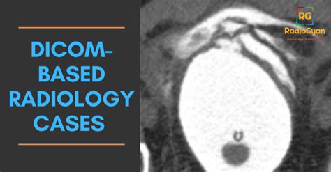 Dicom Radiology Cases Set 2 Cases 4 6 Radiogyan