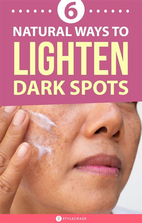 How To Remove Dark Spots On Face Fast 6 Home Remedies In 2020 Dark
