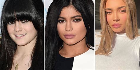 Surgery Make Up Or Both The Transformation Of Kylie Jenner YAAY Entertainment