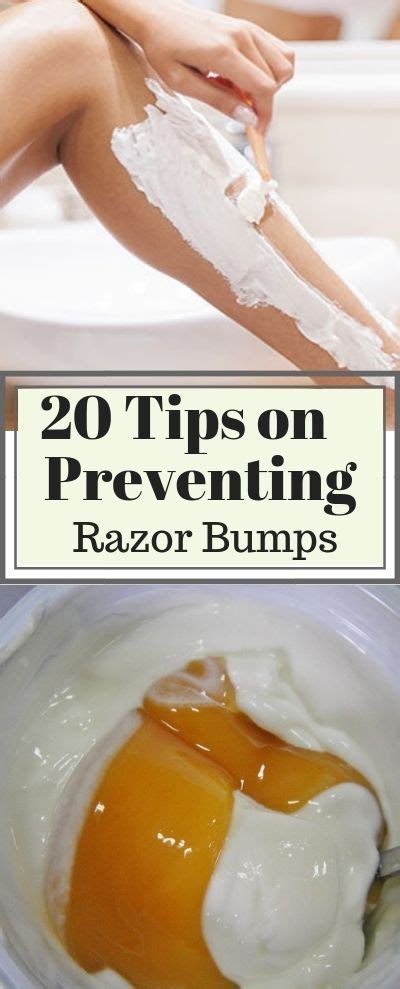 20 Quick Tips And Remedies To Get Rid Of Razor Bumps And Burns Fast