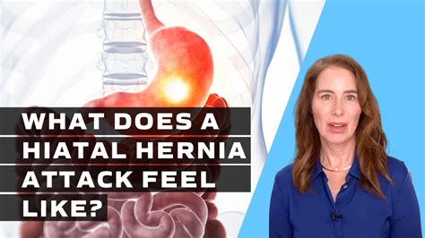 What Does A Hiatal Hernia Attack Feel Like