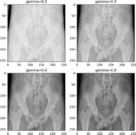adjustments of contrast and luminance of pelvis x ray image download scientific diagram