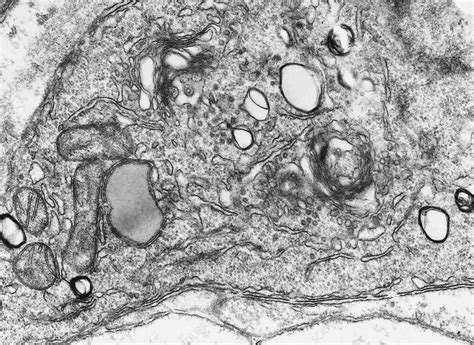 Check spelling or type a new query. Animal cell, TEM - Stock Image - C013/1439 - Science Photo ...