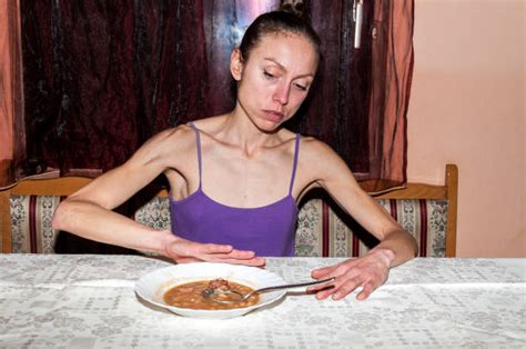You have the munchies, but your not high. Best Anorexia Nervosa Stock Photos, Pictures & Royalty ...