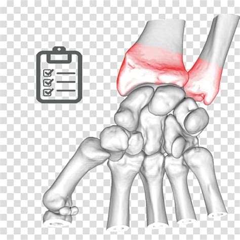 Thumb Elbow Bone Ulnar Nerve Joint Stale Transparent Background PNG