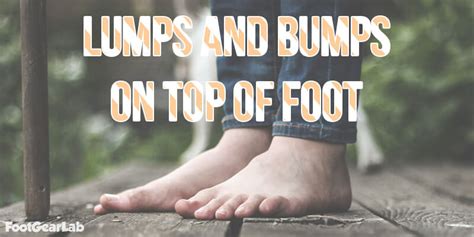 Lumps And Bumps On Top Of Foot Causes Symptoms And Treatment