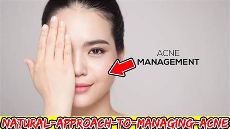 Natural Approach To Managing Acne Loan Nguyen Acne Treatment Acne