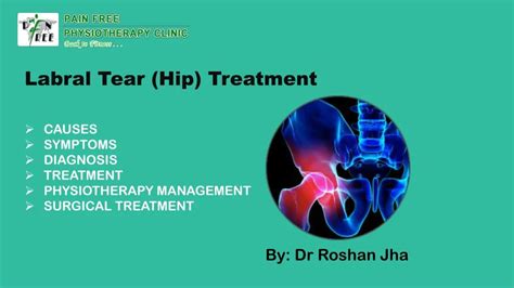 Ppt Hip Labral Tear Treatment Pain Free Physiotherapy Clinic