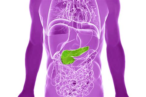 Infographic Pancreatic Cancer Risks Types Stages Upmc
