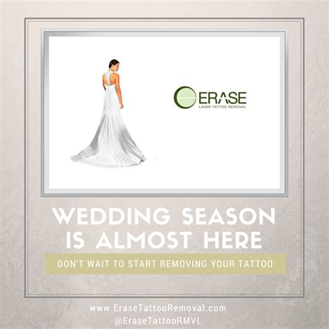 If you are looking for a tattoo removal cream, then you can try out the profade tattoo removal cream which consists of three creams. Erase Tattoo Removal: Summer Weddings & Tattoo Removal