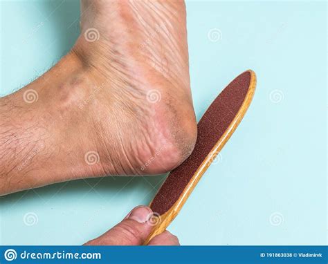 The Man Scrapes The Rough Skin Off The Heel Of His Left Foot Stock