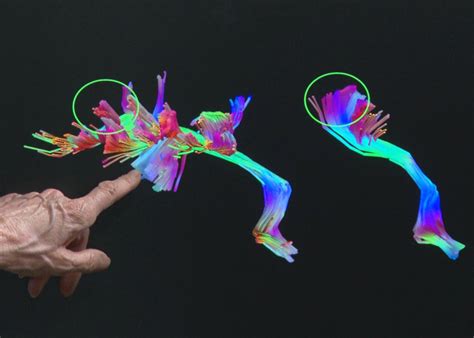 An imbalance in inhibitory/excitatory neurotransmission is proposed to affect the autistic brain, but empirical evidence. Care and Feeding of your Aspie: Part 37 - The Autistic ...