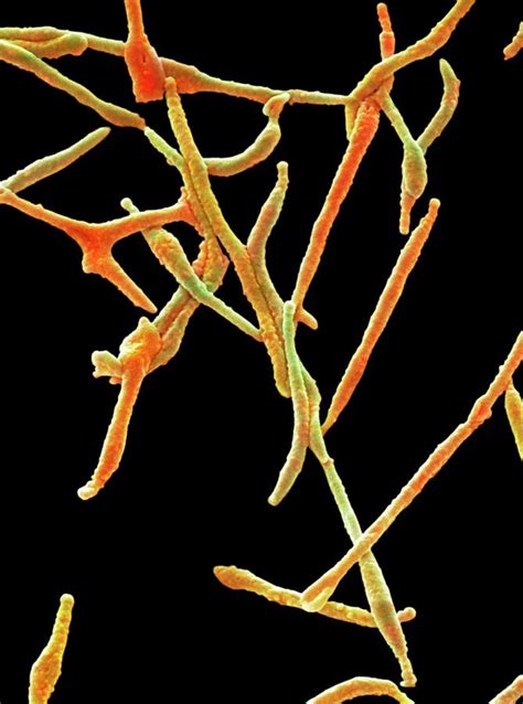 Mycoplasma Pneumoniae Photograph By Steve Gschmeissner