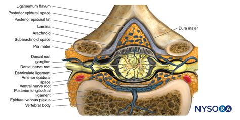 We did not find results for: Epidural anesthesia - NYSORA e-Learning System