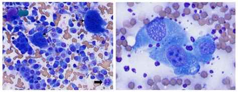 Basal Cell Tumor Dog Cytology