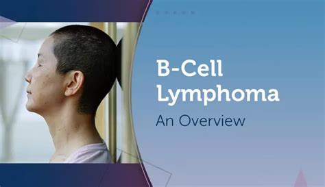 B Cell Lymphoma An Overview Mylymphomateam