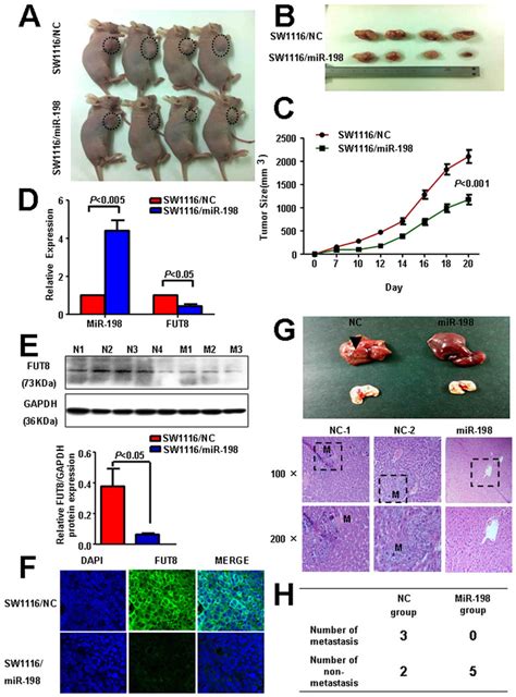 Mir Knockdown Suppresses Crc Cell Growth And Metastasis In Nude My