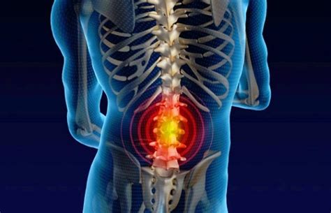 Severe Lower Back Pain How To Deal With How To Get Rid Of Back Pain
