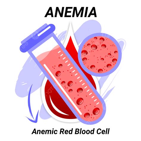 Red Blood Cells White Transparent Red Blood Iron Deficiency Anemia