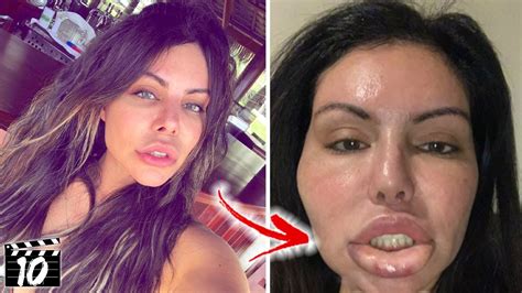 Top Celebrity Plastic Surgery Horror Stories Youtube