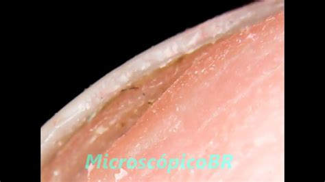 Sujeira Da Unha No Microscópio
