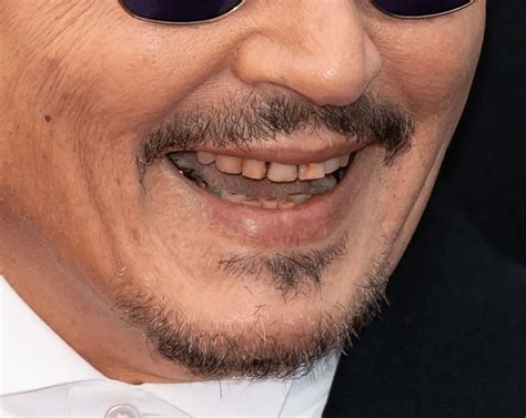 What Is Going On With Johnny Depps Teeth Photos Whats Up Today