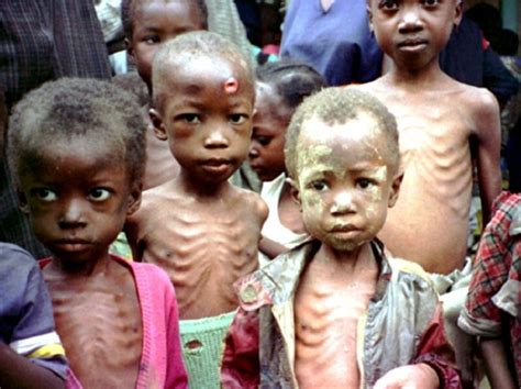 Unicef Over 2m Nigerian Children Suffer From Acute Malnutrition