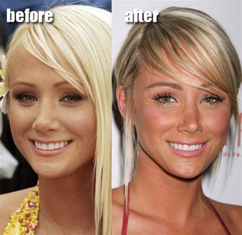 Sometimes we forget celebrities are human too, and like us, they also have their #nomakeup days! Celebrity Plastic Surgery Before & After (56 pics ...