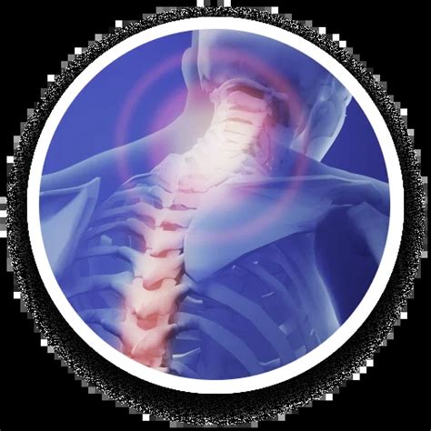 Cervical Epidural Steroid Injections Az Pain And Spine Institute