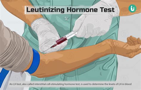 एलएच ल्यूटीनाइज़िन्ग हार्मोन टेस्ट क्या है खर्च कब क्यों कैसे होता है lh luteinizing