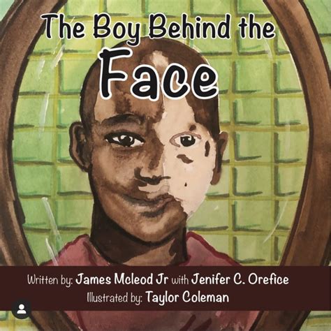 The Boy Behind The Facee Book Thatvitiligoguy