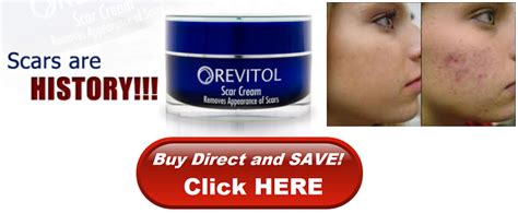 Revitol Scar Cream Review A Scar Tissue Home Removal Treatment That Actually Works