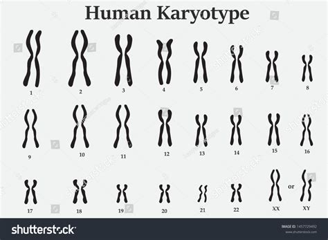 Karyotype Of Normal Human Chromosome Royalty Free Stock Vector