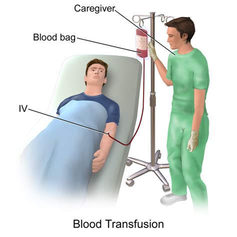 Is Fever A Contraindication For Blood Transfusion Epomedicine