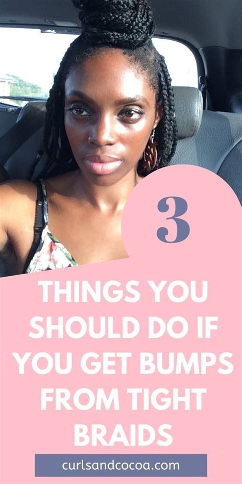 Bumps From Braids Too Tight And Why It Should Worry You Bump