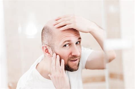 Male Alopecia A Man With A Bald Head Rear View Gray Background Stock
