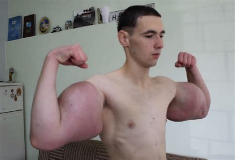Muscle Oil Injecting Gym Bro Illustrates Dangerous Bodybuilding Practice Nsfw Ot