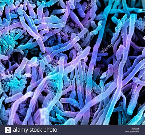 Streptomyces Coelicoflavus Bacteria Coloured Scanning Electron