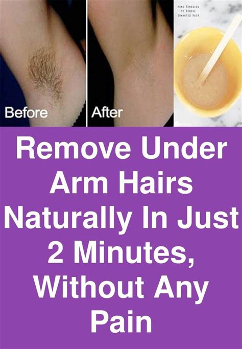 Hair Bumps On Head Removal 125 Best Haircuts In 2020