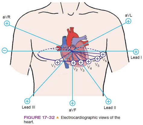 Electrical Axis Cardiac Nursing Coronary Arteries Critical Care Nursing