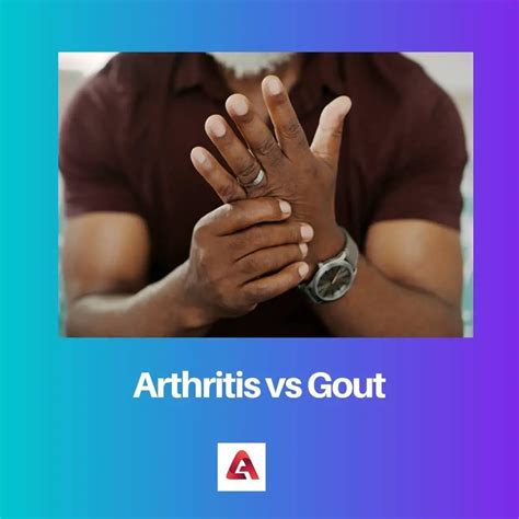 Difference Between Arthritis And Gout