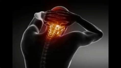 Neck Pain Causes Symptoms Prevention And Treatments Youtube