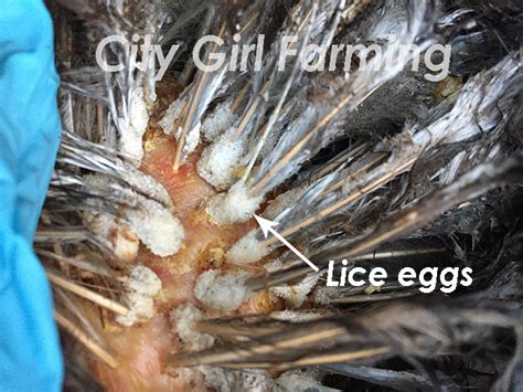 Lice Eggs City Girl Farming Sustainable Living For Regular People