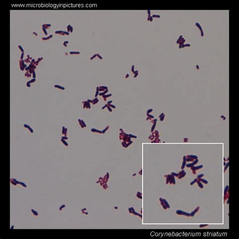 Corynebacterium Striatum Microscopy Diphtheroids Gram Stained And Cell