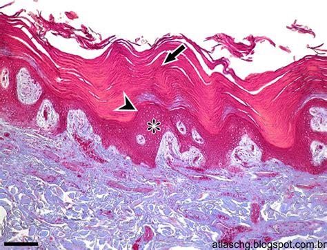 Atlas De Citologia E Histologia Tecido Epitelial De Revestimento Porn