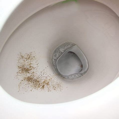 What Is The Black Stuff Around The Rim Of Toilets Good Ideas N Advice Toilet Bowl Stains