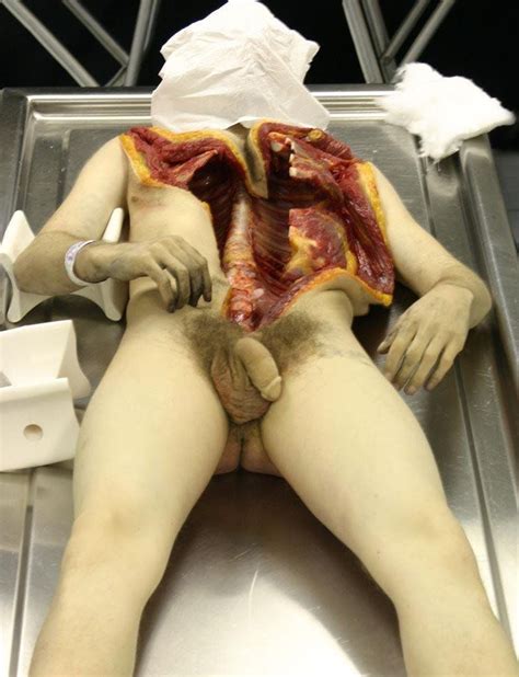 China Girl Autopsy