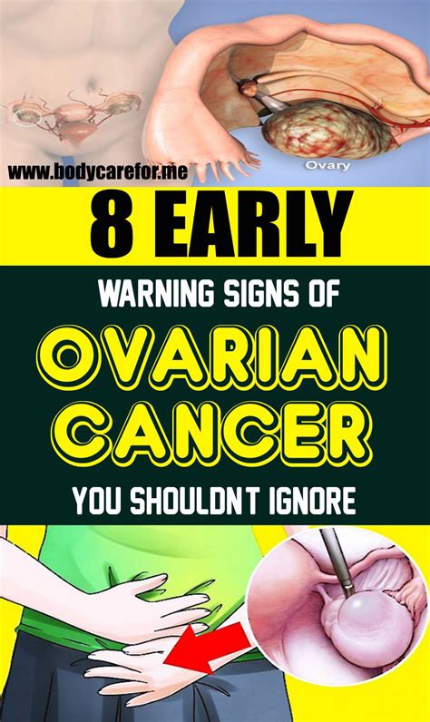 8 Early Warning Signs Of Ovarian Cancer You Shouldnt Ignore