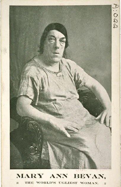 Mary ann bevan 20 december 1874 26 december 1933 was an english woman who after developing acromegaly toured the sideshow circuit as the ugliest woman. Blog Plusultra: Who would marry Mary Ann Bevan?