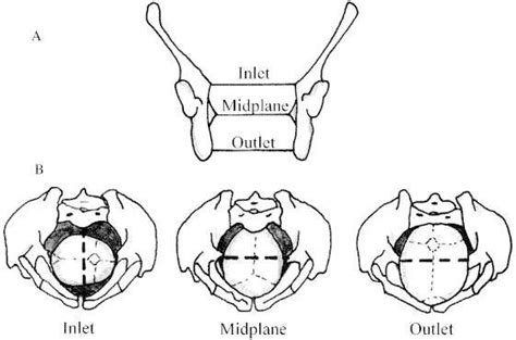 Pelvic Inlet And Outlet Dylanrilrtuart